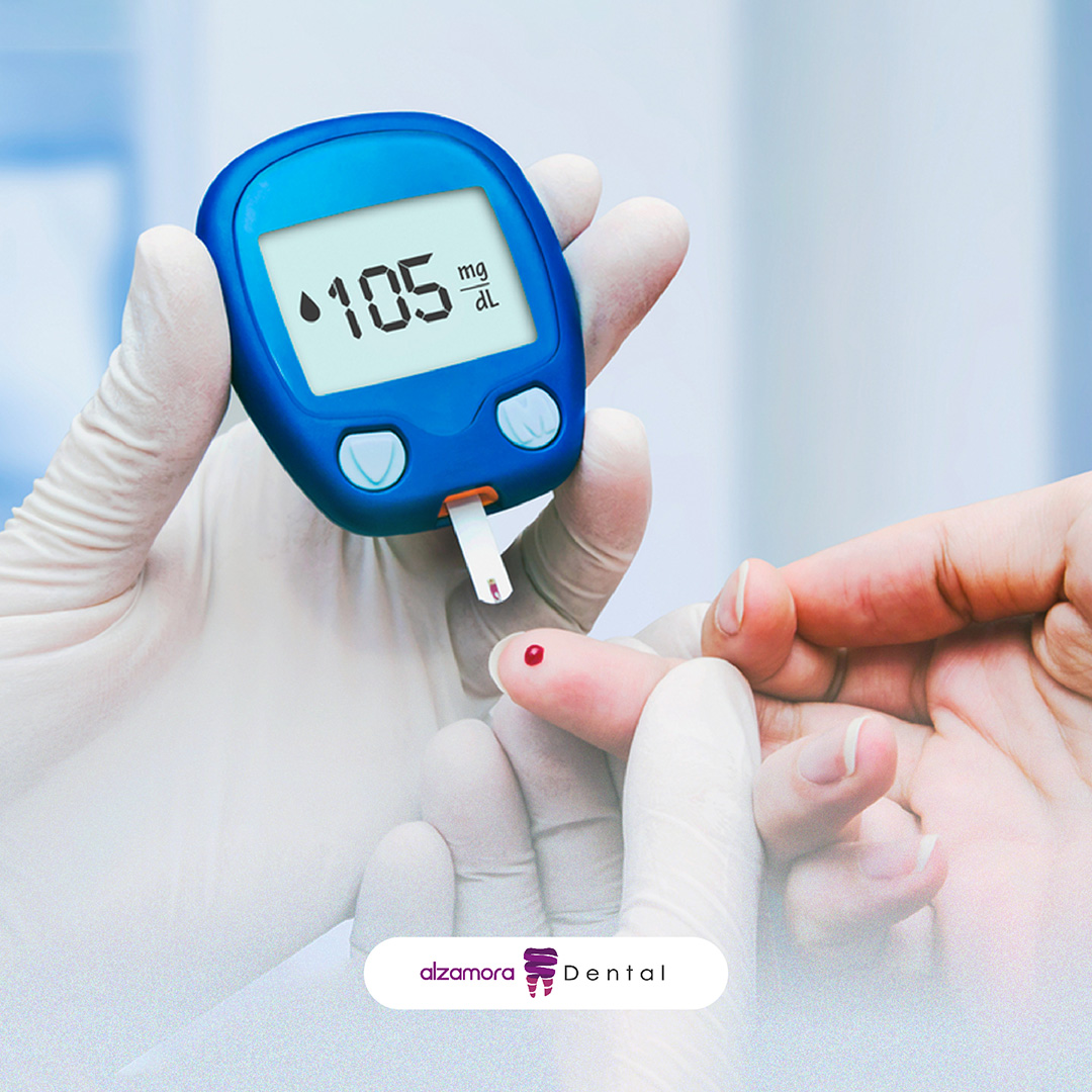 Diabetes Mellitus y la Salud Bucal